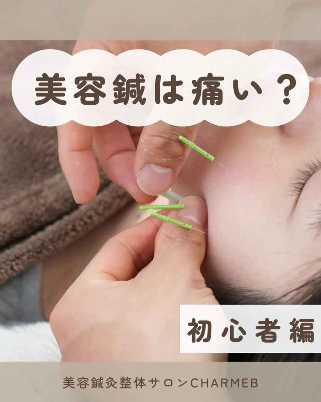 美容鍼を受けてみたいけど、