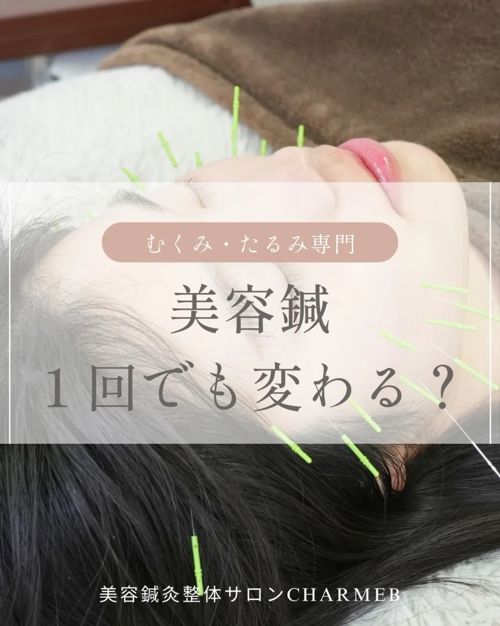 「美容鍼って何回受ければいいですか？」