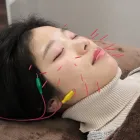 たるみ