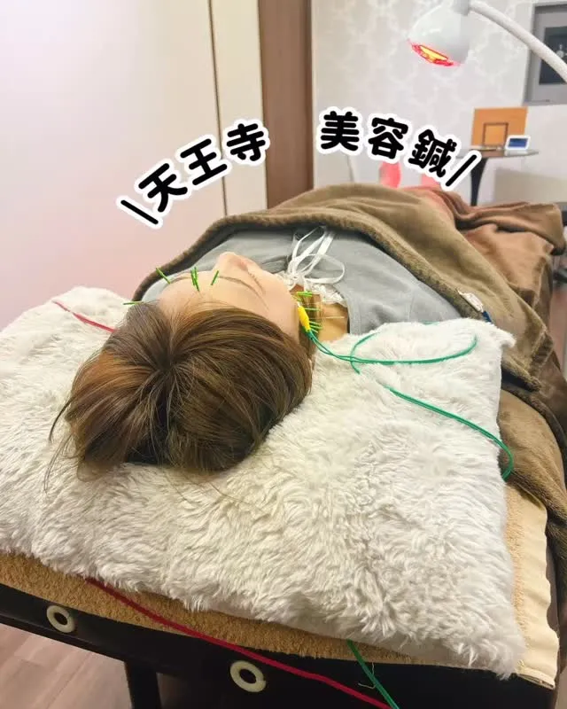 ⁡大阪天王寺のたむみ･むくみ特化の美容鍼